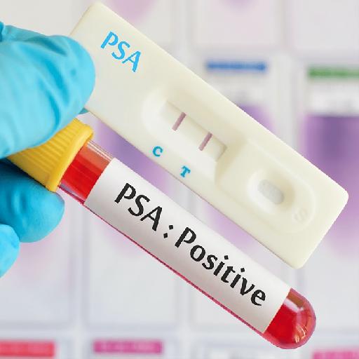 Dlabs - PSA Quantitative