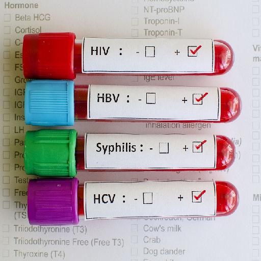 Dlabs - STIs Screen (HBV, HCV, Retroscreen 1&2, VDRL)
