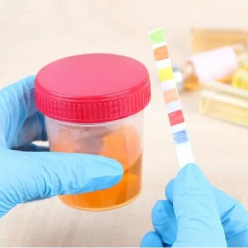 Dlabs - Urine Analysis