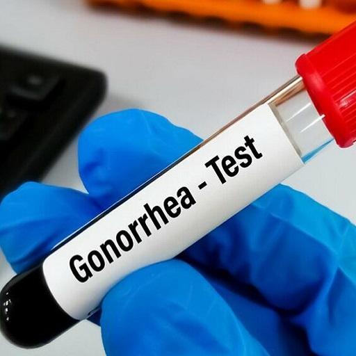 Dlabs - Gonorrhea Testing