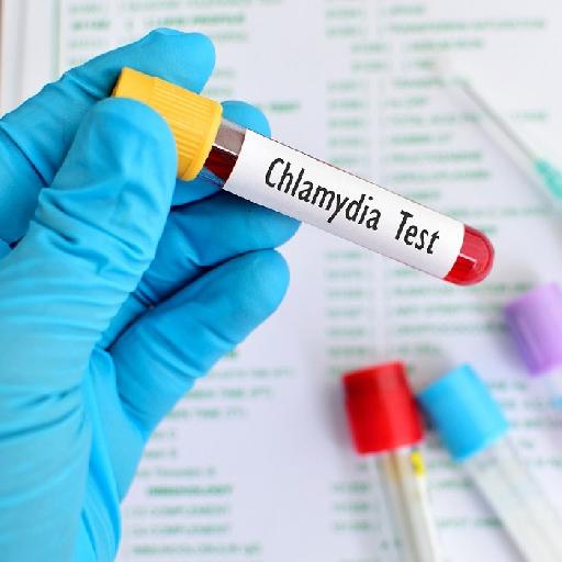Dlabs - Chlamydia Testing