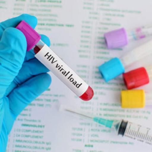 Dlabs - Viral Load Testing