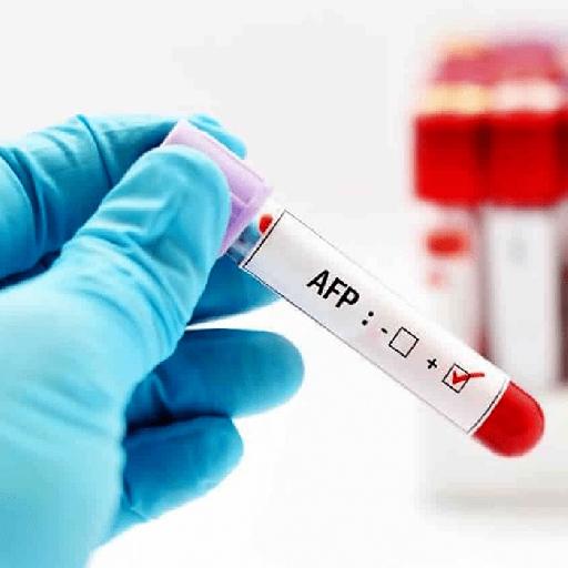 Dlabs - Tumor Marker AFP (Liver) Testing