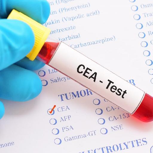 Dlabs - Tumor Marker CEA (General) Testing