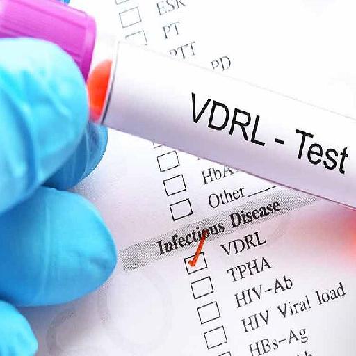 Dlabs - TPHA ( If VDRL is reactive) Testing