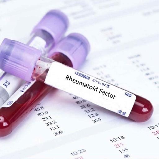 Dlabs - Rheumatoid Factor Testing