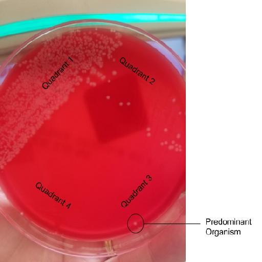 Dlabs - Aspirate Culture & Sensitivity Testing