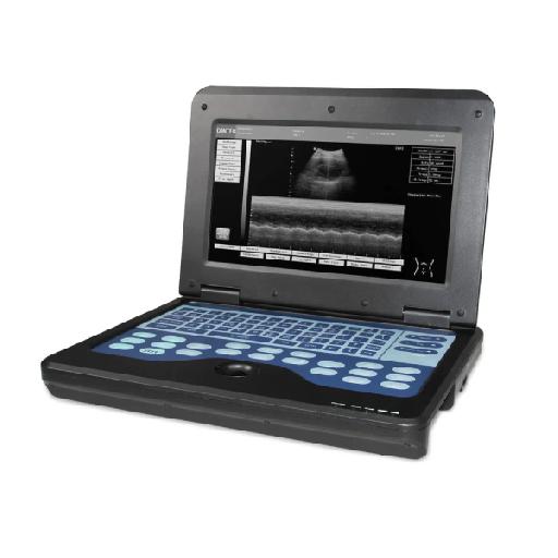 McSarpong - CONTEC CMS600P2 Doppler Ultrasound Machine | Portable B-Ultrasound Diagnostic System