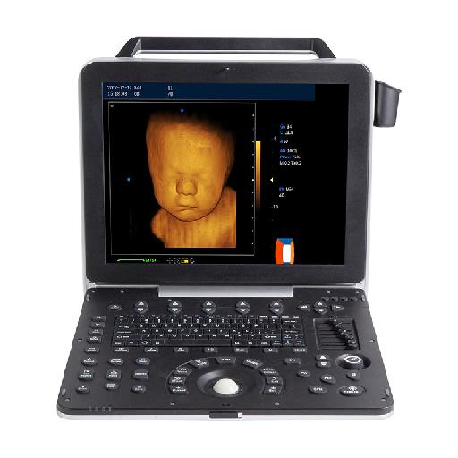 McSarpong – Full-Body Application Color Portable Doppler Ultrasound Machine