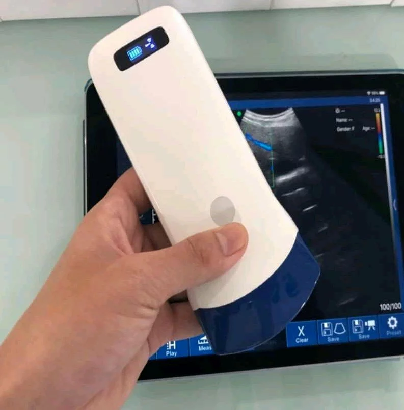 Wireless Ultrasound Studio Kit - Convex Probe, 40-Print Thermal Printer, 10" Monitor