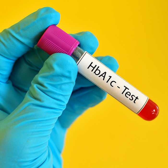 Dlabs - HBA1c