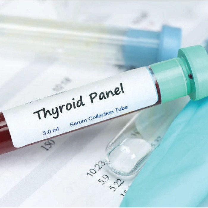 Dlabs - Thyroid Function Tests (TFTs)