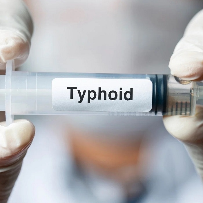 Dlabs - Typhoid Serology