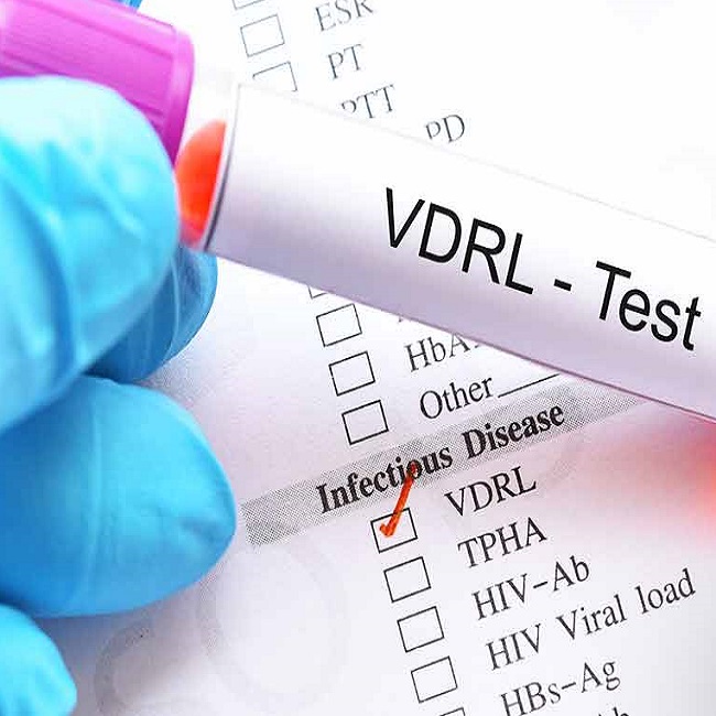 Dlabs - TPHA ( If VDRL is reactive) Testing