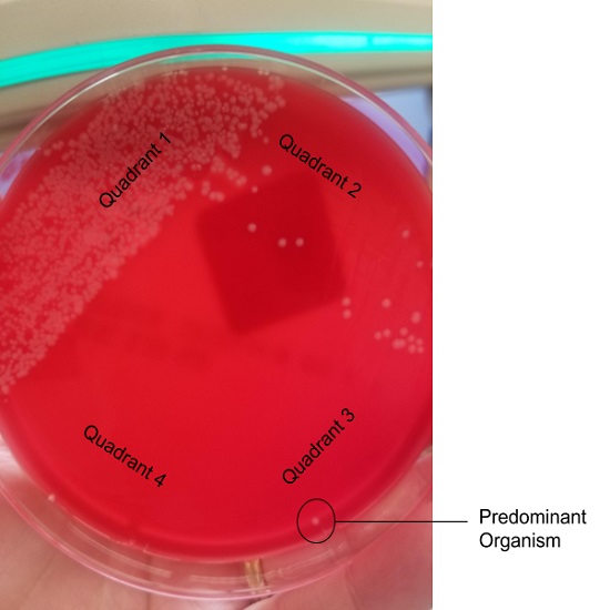 Dlabs - Aspirate Culture & Sensitivity Testing