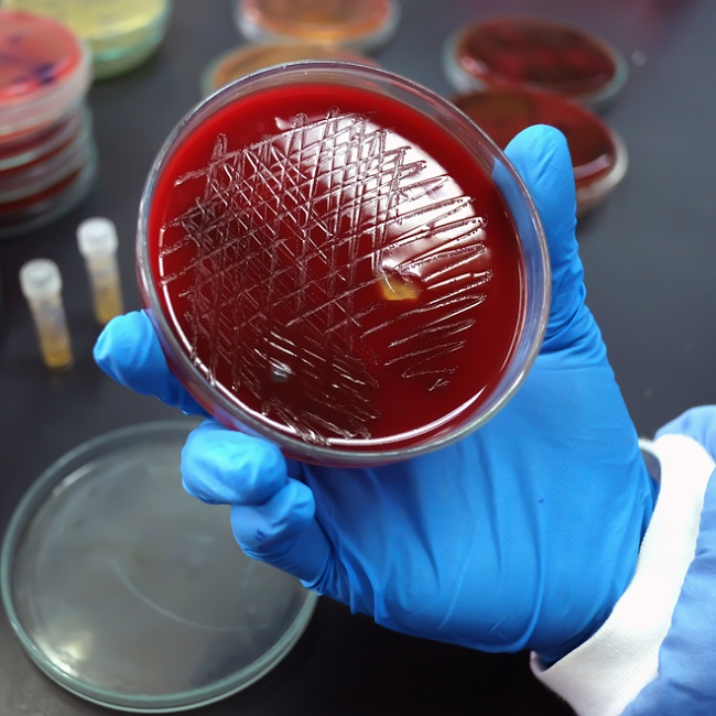Dlabs - Blood Culture & Sensitivity Testing