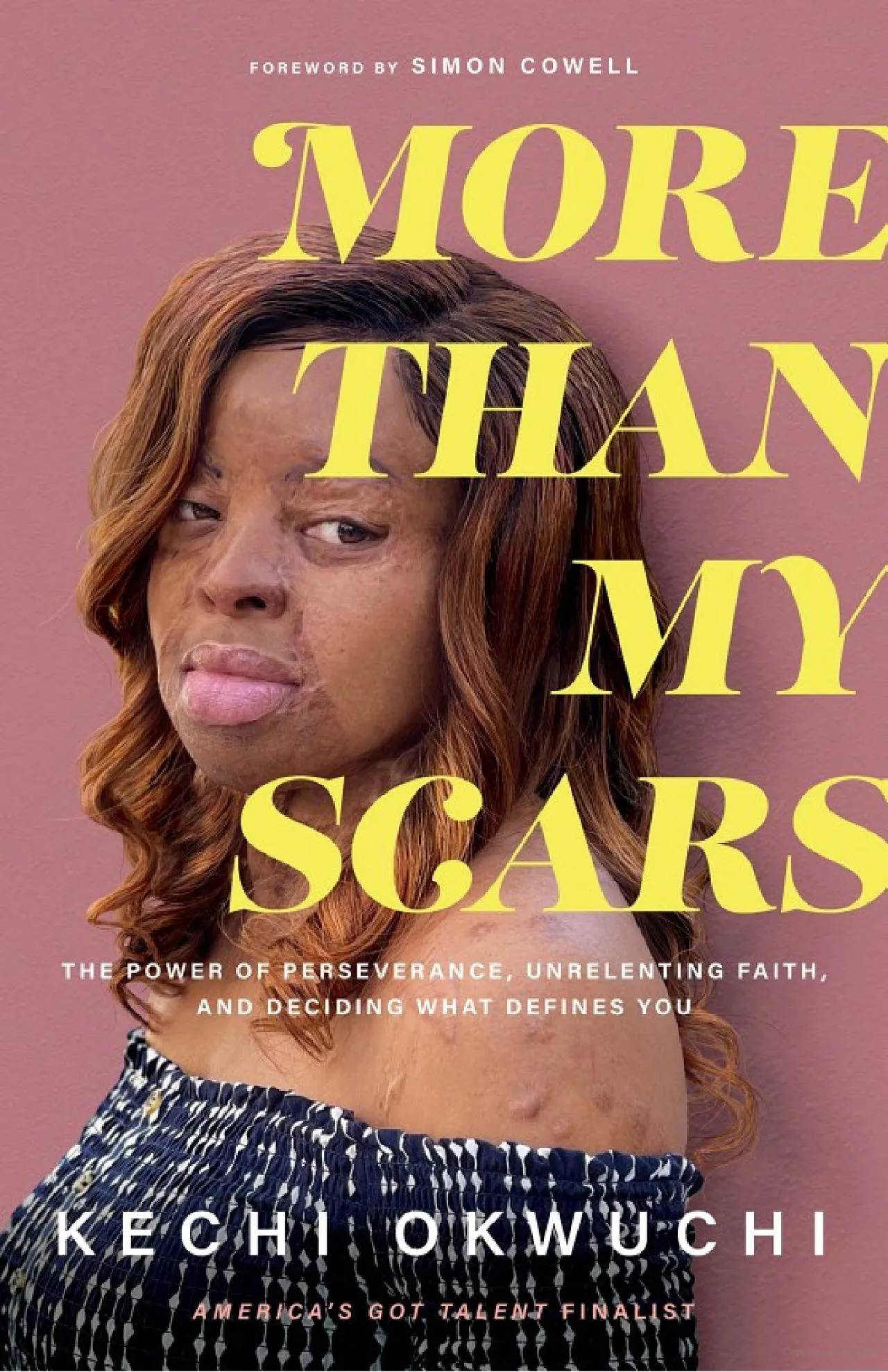 More Than My Scars – The Power of Perseverance, Unrelenting Faith & Deciding What Defines You