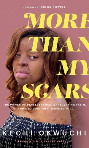 More Than My Scars: The Power of Perseverance, Unrelenting Faith, and Deciding What Defines You - Acid Attack Survivor Memoir