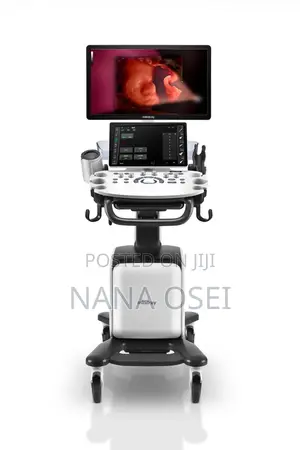 3D 4D Mindray Consona N6 Series for Ultrasound | High-Resolution | Multi-Probe | 2D/3D/4D Imaging | Colour Doppler | Clinical Use