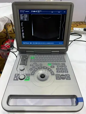 Portable Ultrasound Machine (With Convex Probe) | High-Resolution B-Mode | Color Doppler | Multi-Probe | Measurements & Annotations
