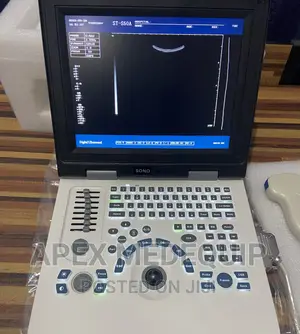Ultrasound Scan Machine + 1 Convex Probe