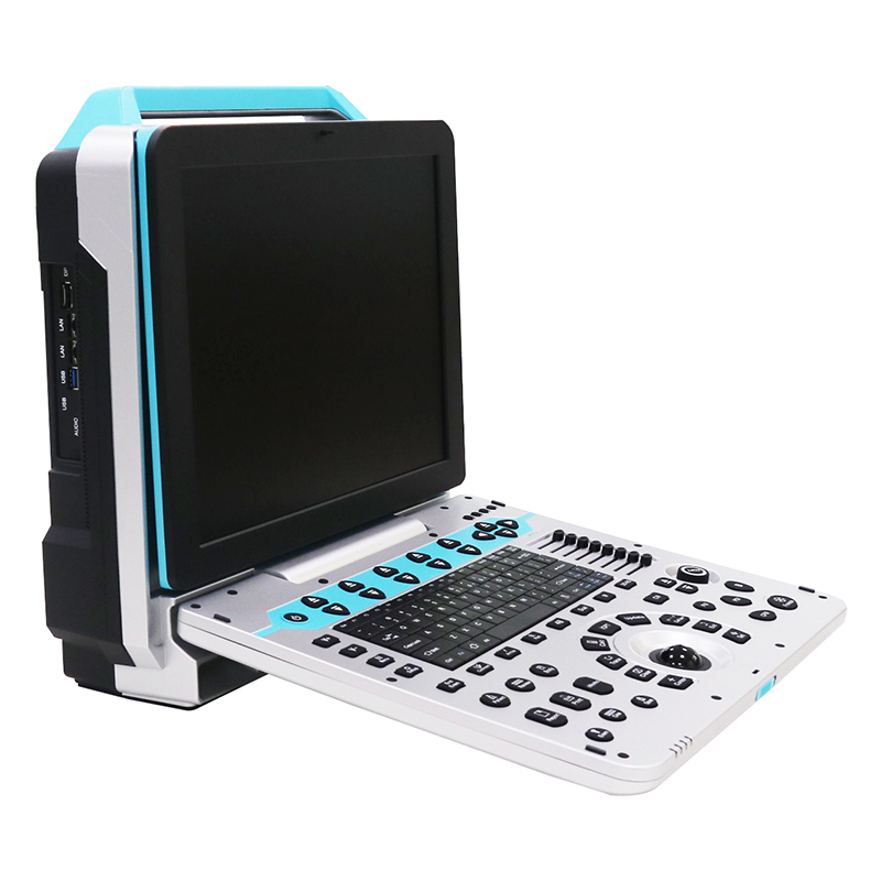 McSarpong – Portable Color Ultrasound Machine