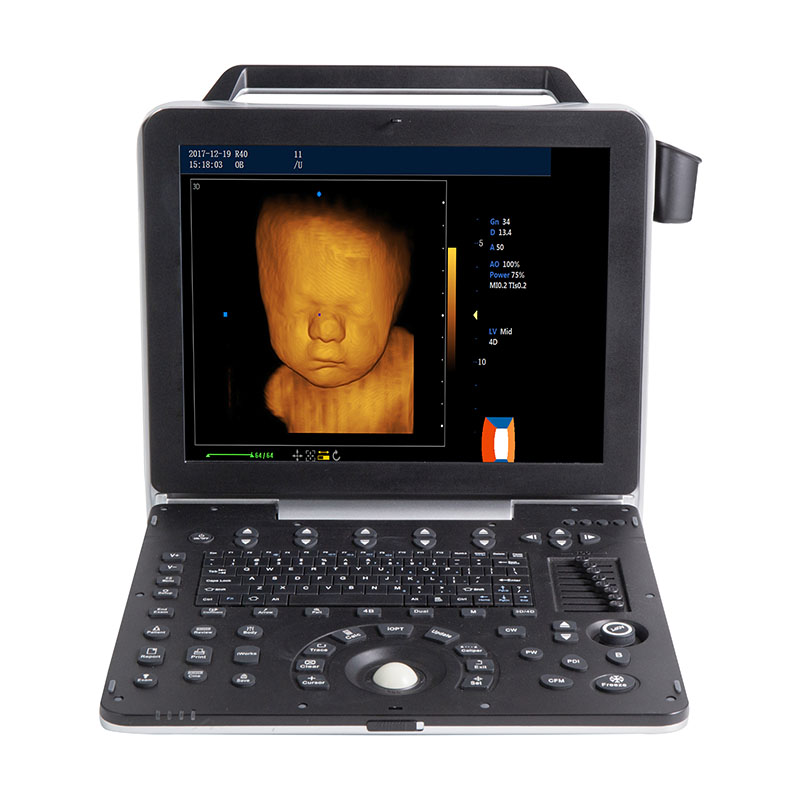 McSarpong – Full-Body Application Color Portable Doppler Ultrasound Machine