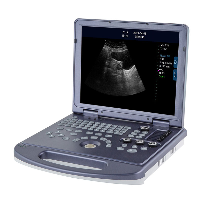 McSarpong – PC Platform B/W Doppler Ultrasound Machine