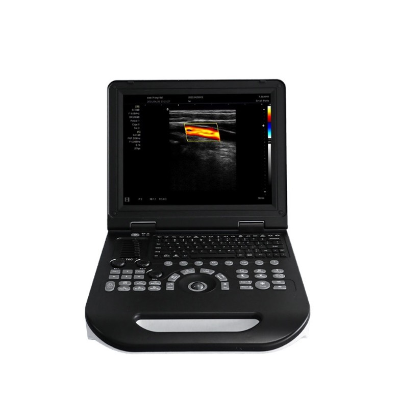 McSarpong – Notebook Color Doppler MDW-XFE30