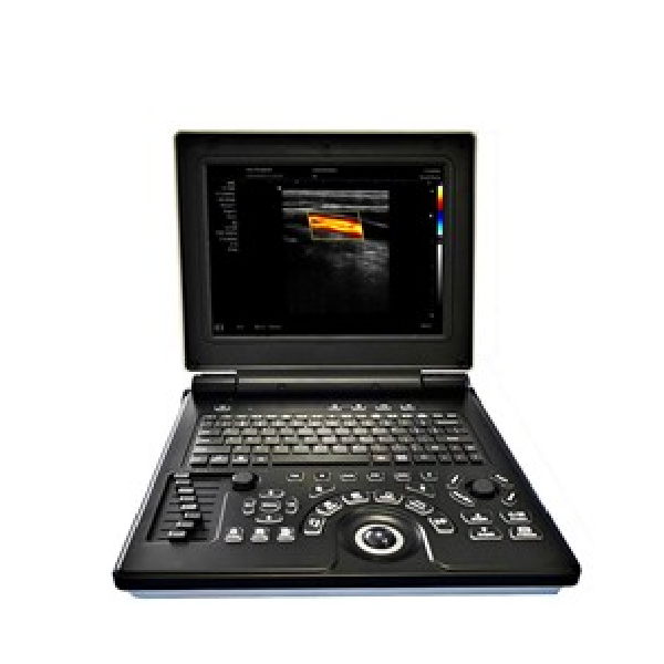 McSarpong – Notebook Color Doppler Machine MYXF-E20 (Convex Transducer)