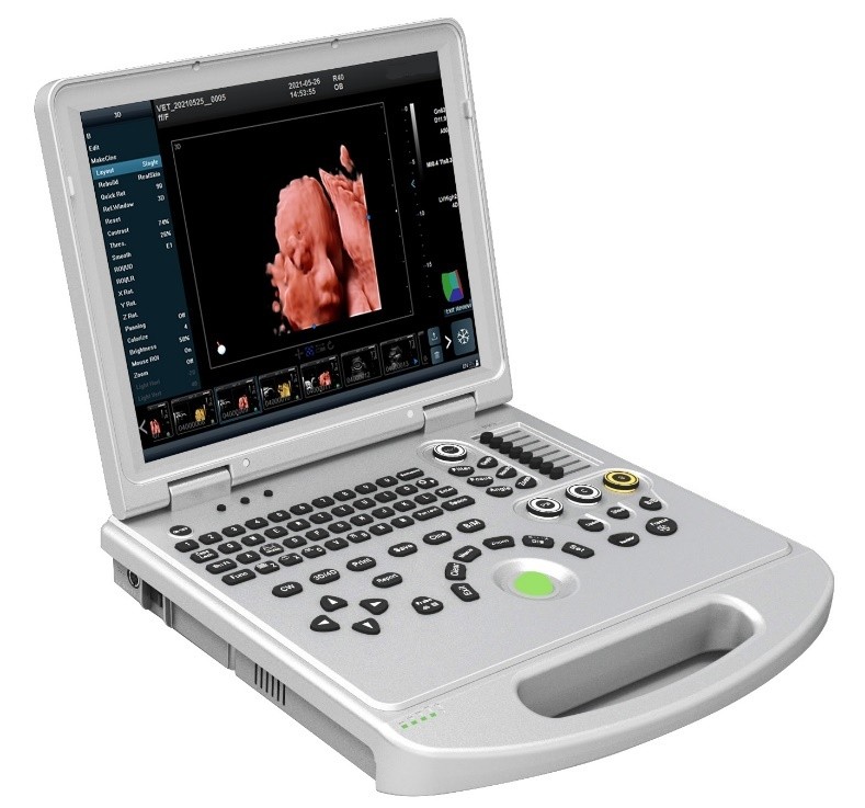McSarpong – Real-Time 4D Color Doppler Ultrasound Scanner Machine DW-T8 V4.0